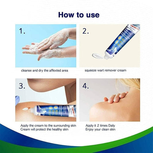 Advanced Wart Remover Cream – Fast-Acting Treatment for Warts, Moles & Skin Tags