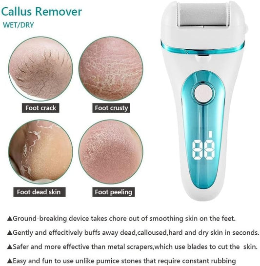 Electric Foot Callus Remover with LED Light – Smooth Feet